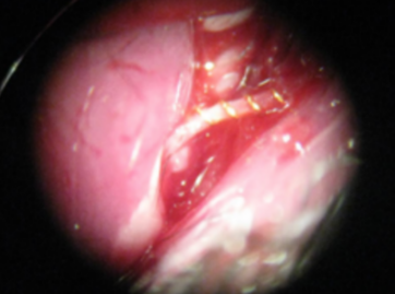 動物実験用マイクロコイル